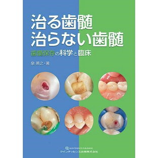 治る歯髄 治らない歯髄 ／ クインテッセンス出版の画像