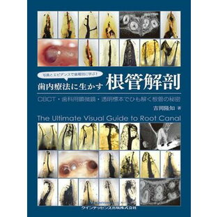 写真とエビデンスで歯種別に学ぶ！ 歯内療法に生かす根管解剖 ／ クインテッセンス出版の画像