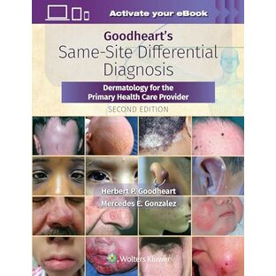 Goodheart's Same-Site Differential Diagnosis: Dermatology for the Primary Health Care Providerの画像