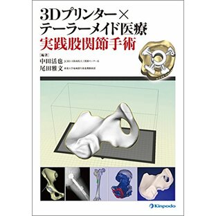3Dプリンター×テーラーメイド医療 実践股関節手術の画像