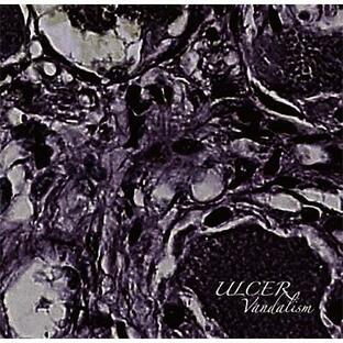 Ulcer Vandalismの画像