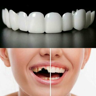 入れ歯 義歯 付け歯 2組の男女は即時に義歯を貼り インスタント入れ歯 差し歯接着剤簡易 男女兼用 簡単装着 部分付け歯 自信を持って微笑む (B)の画像