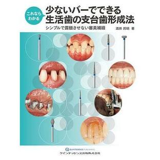 これならわかる 少ないバーでできる生活歯の支台歯形成法 ／ クインテッセンス出版の画像